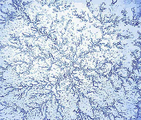 Bilder_1/
			intakte-struktur.jpg